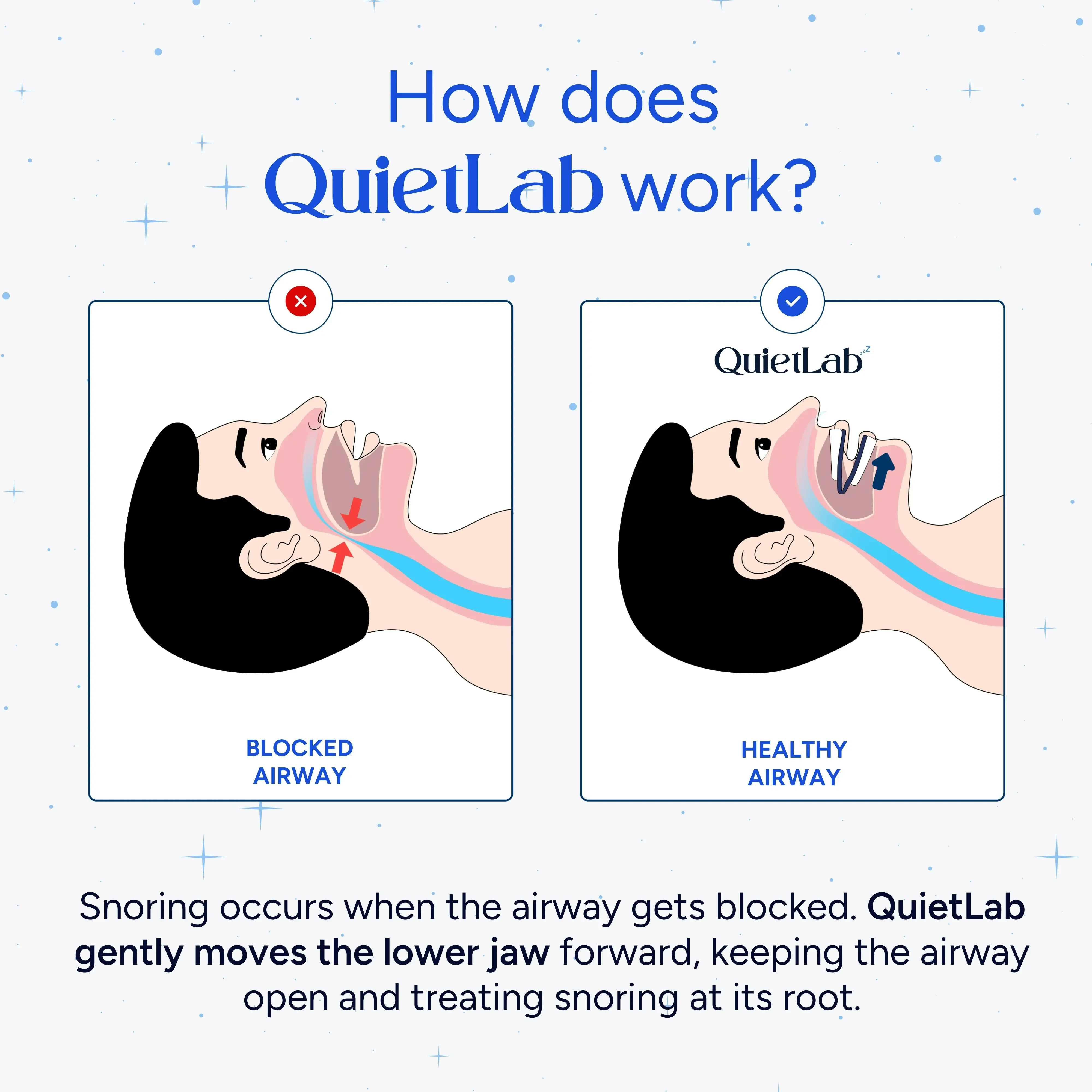 Quietlab Pro official
